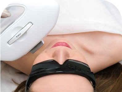 Depilação com Luz Pulsada
