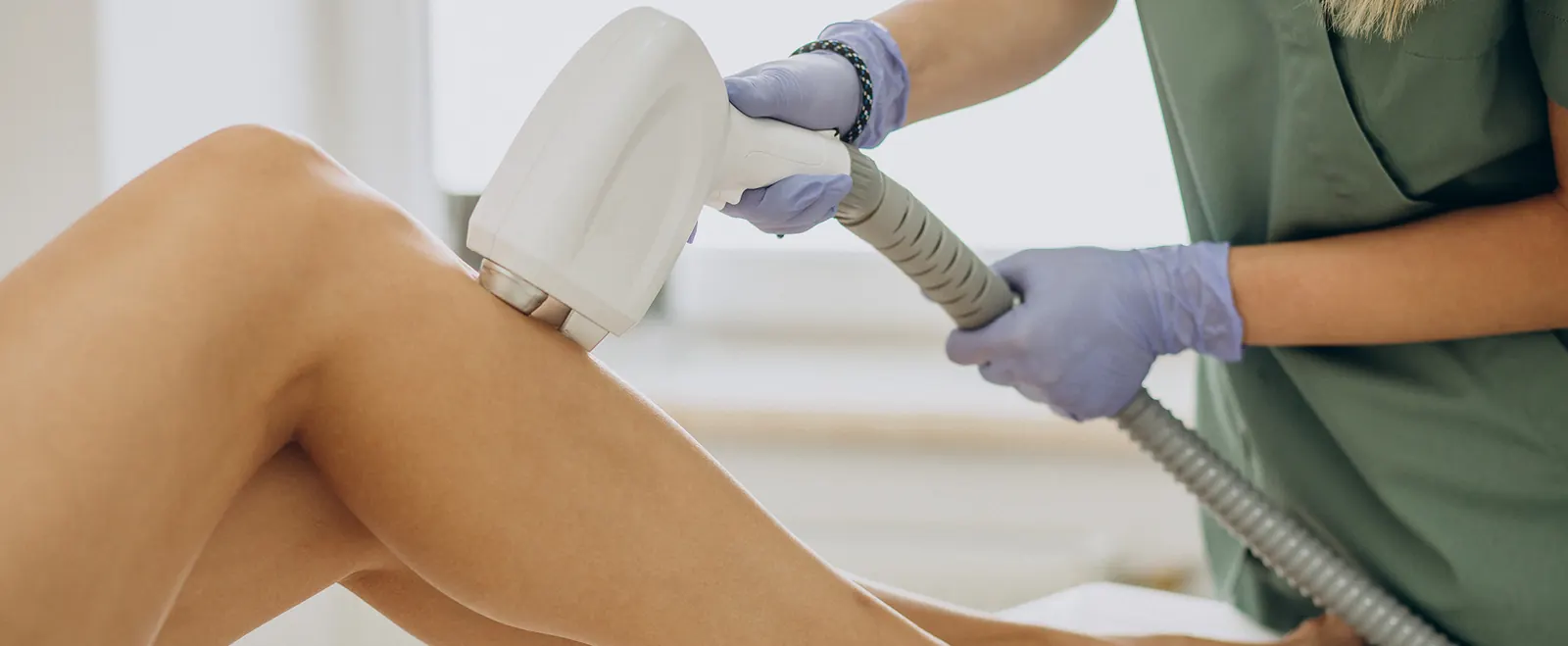 Sessão de depilação a laser na Estilo Laser, em Taguatinga